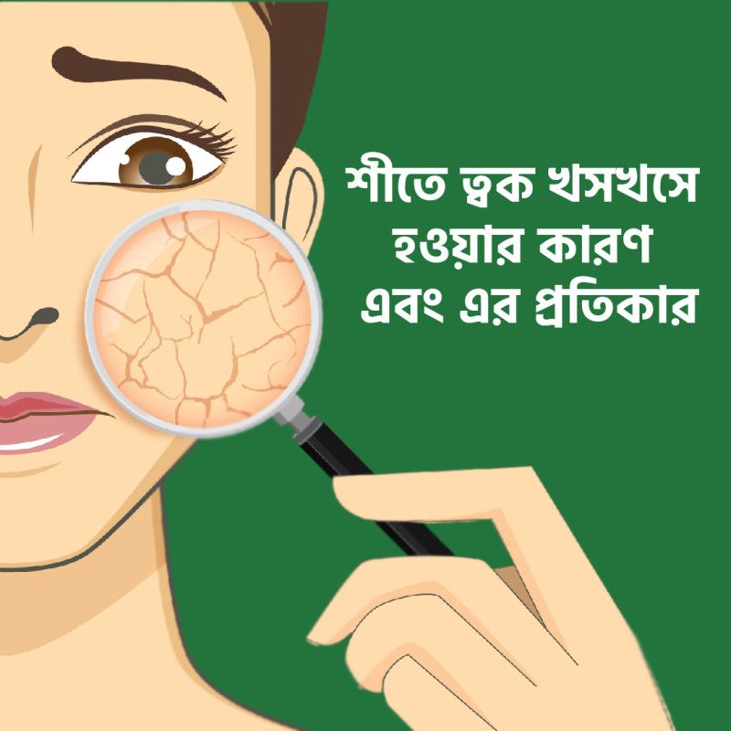 শীতে ত্বক খসখসে হওয়ার কারণ এবং এর প্রতিকার